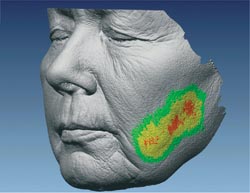 Active remodels facial contours