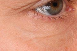 The power of retinol without the irritation