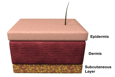 HtrA1 and maintenance of epidermis homeostasis 