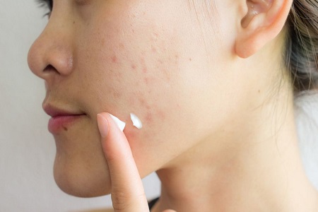 New reports on anti-acne and lip care