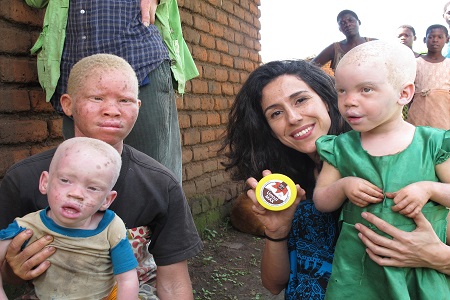 BASF albinism cooperation renewed