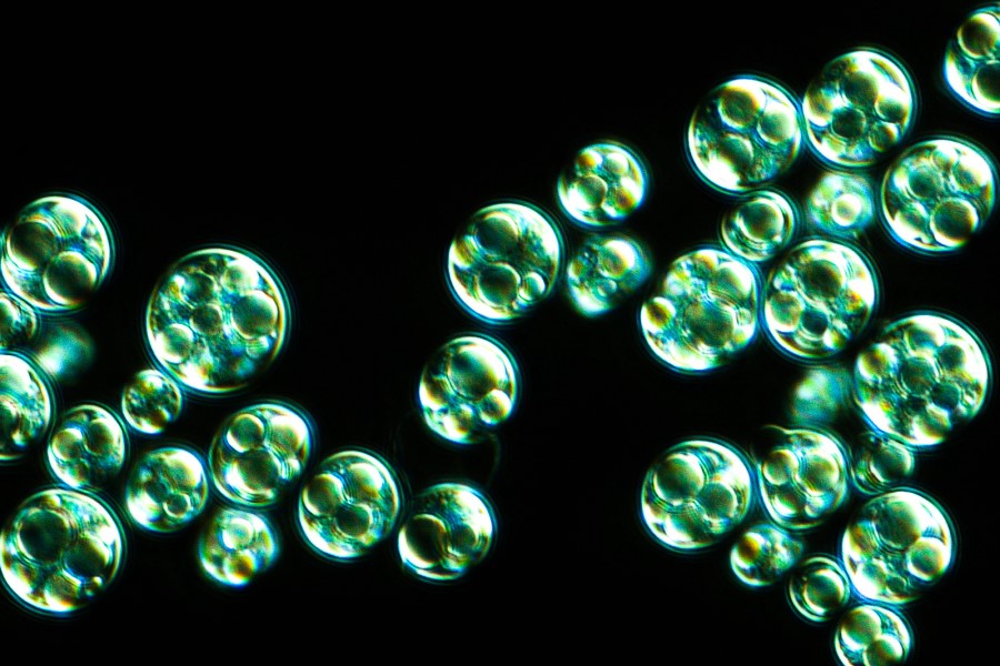 Japan’s DIC Corporation signs microalgae agreement with Checkerspot