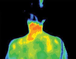 Thermal imaging validates pain reduction approach